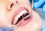 دکتر پرویز چگین دندانپزشک آمل